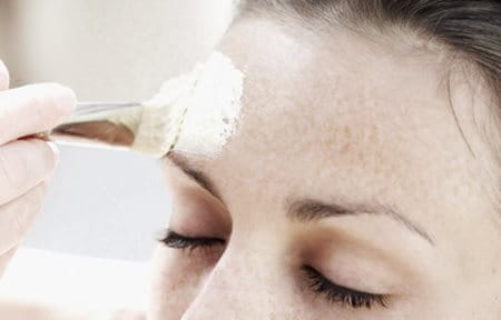Aplicación de exfoliación química en una frente femenina