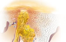 La farmacia china del ungüento de la psoriasis